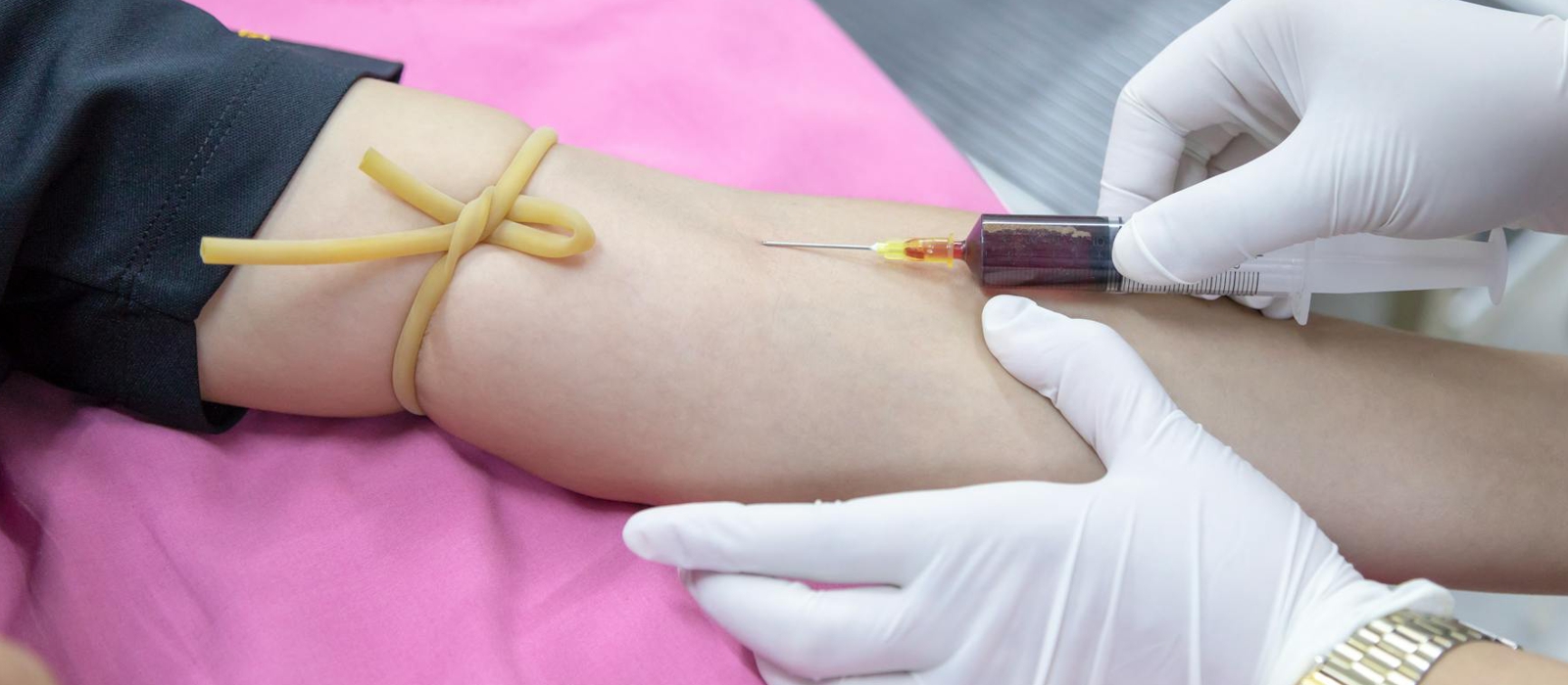 https://www.dobrezdravie.sk/image/cache/catalog/clanky/anemia-1600x700.jpg